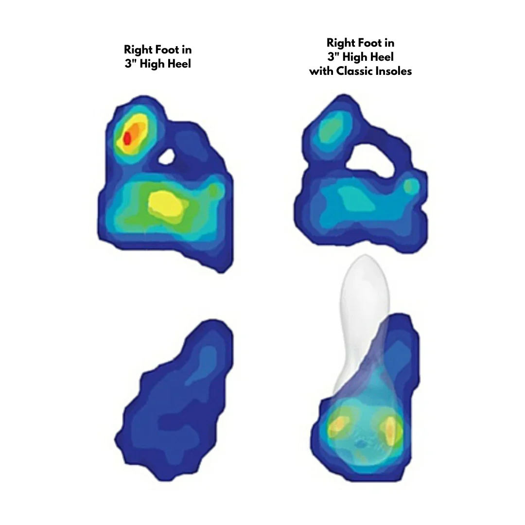 Classic Weight-Shifting Insoles for High Heels - Image 3
